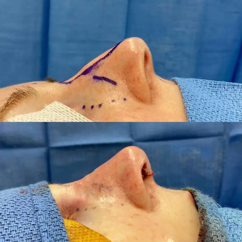 Before & After Photos Kirk Lozada, MD