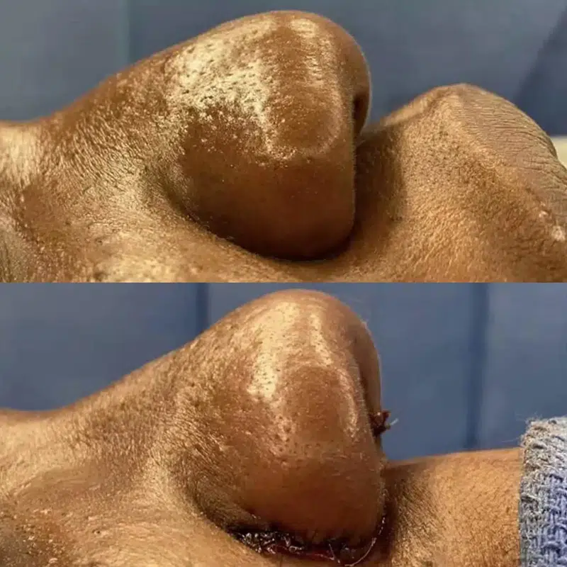 Before & After Photos Kirk Lozada, MD