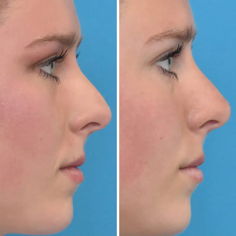 Before & After Photos Kirk Lozada, MD