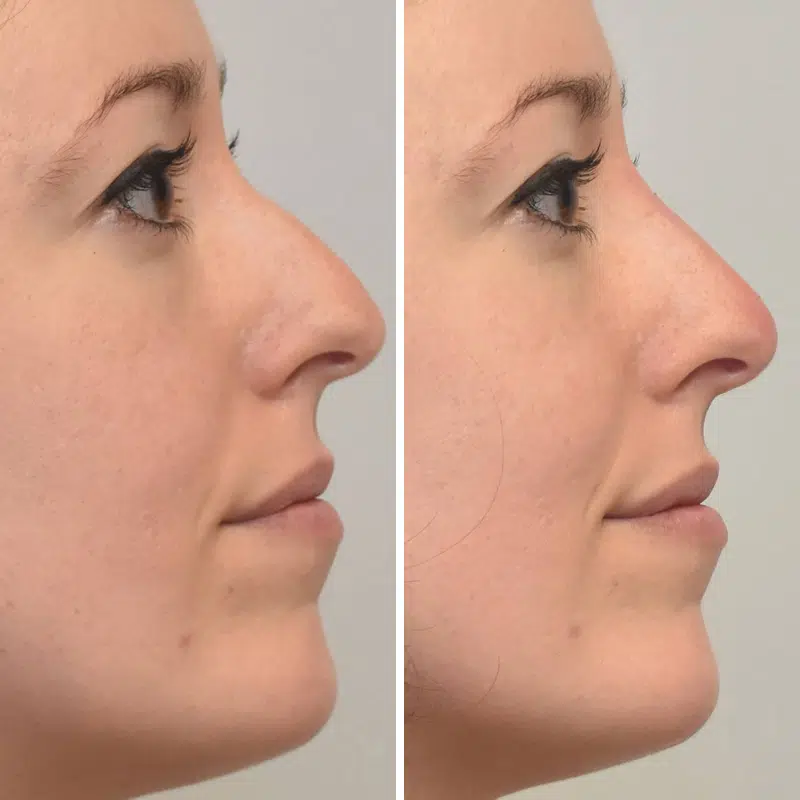 Before & After Photos Kirk Lozada, MD