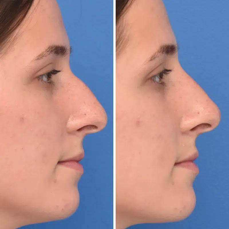 Before & After Photos Kirk Lozada, MD