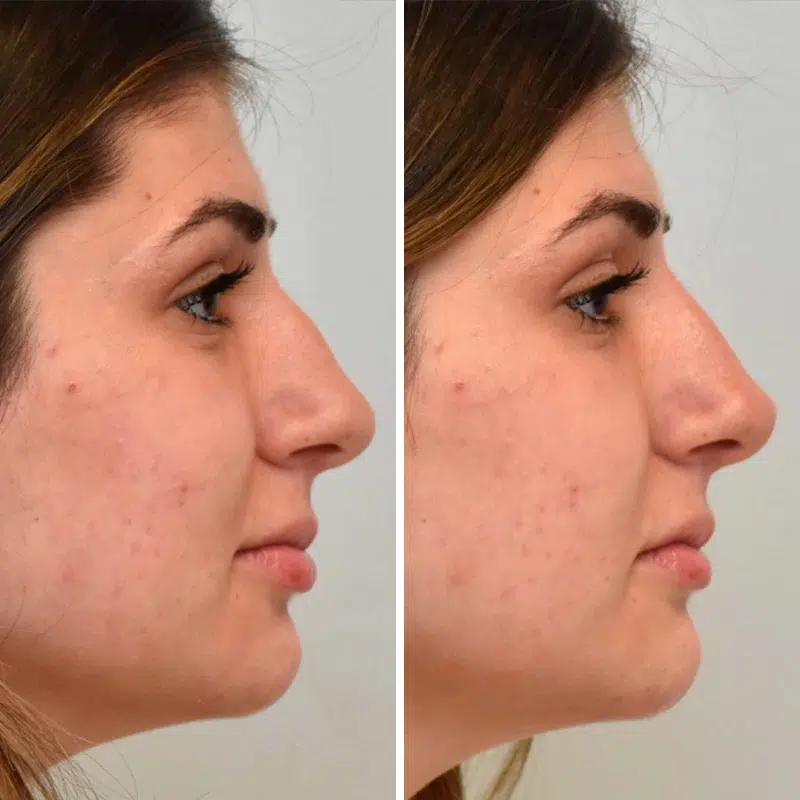 Before & After Photos Kirk Lozada, MD