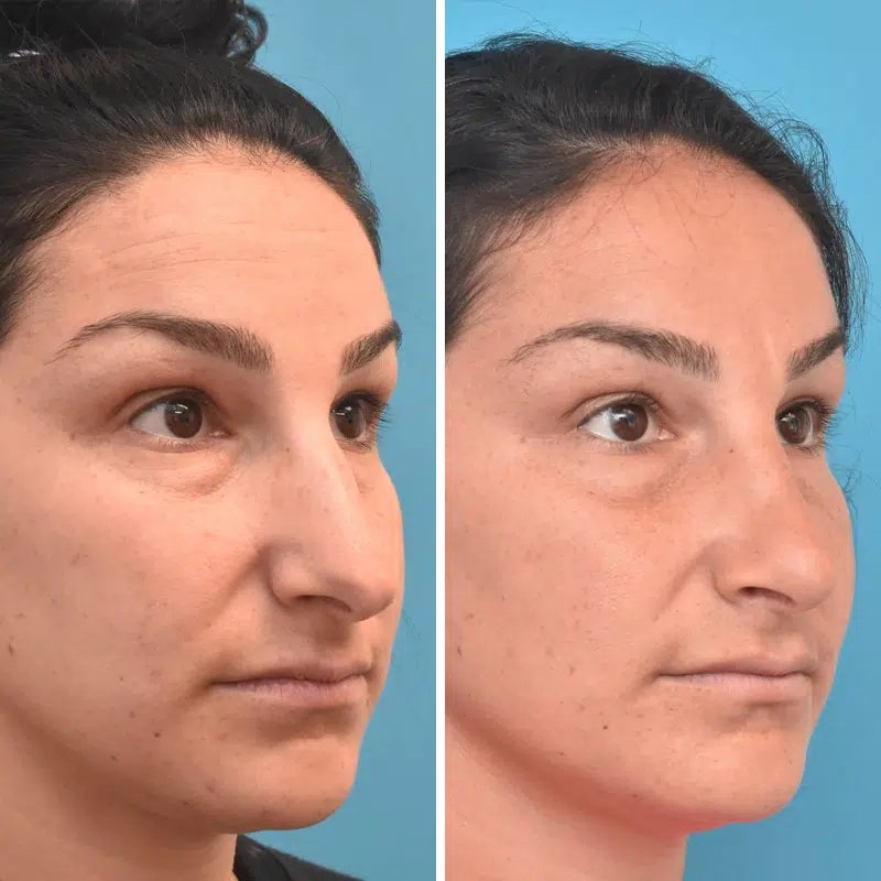 Before & After Photos Kirk Lozada, MD