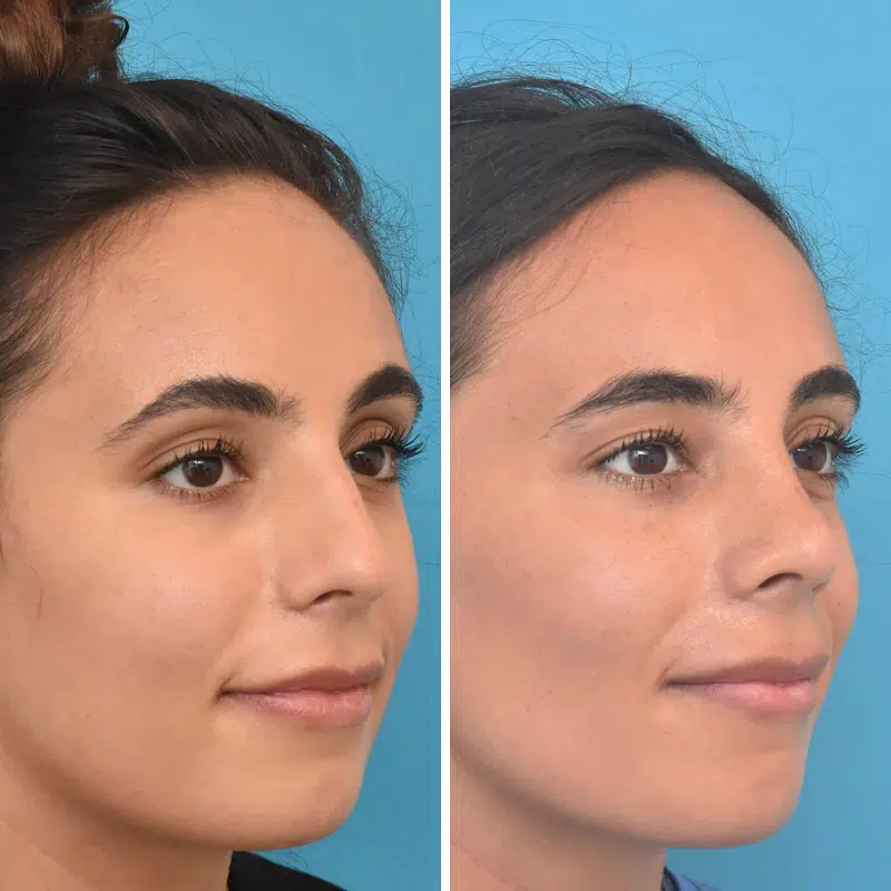 Before & After Photos Kirk Lozada, MD