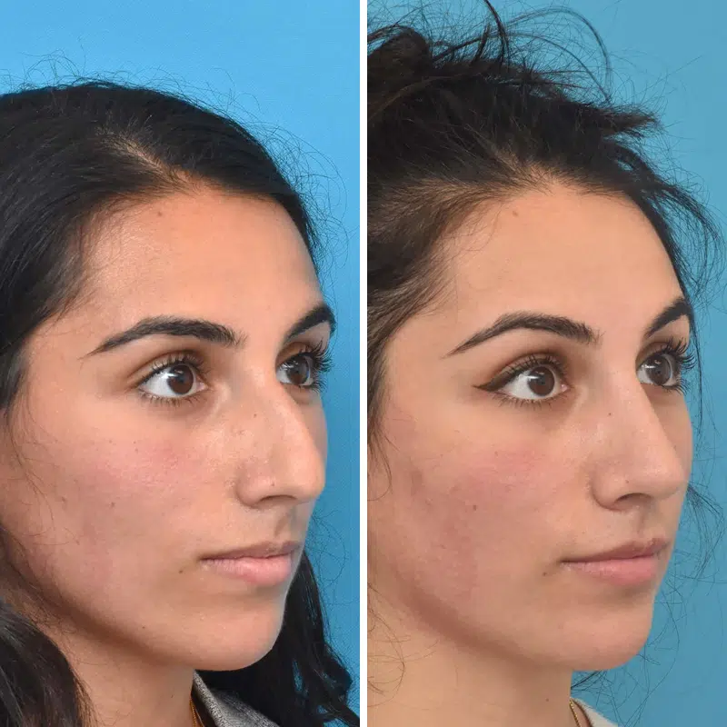 Before & After Photos Kirk Lozada, MD