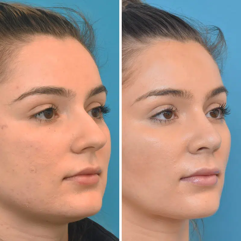 Before & After Photos Kirk Lozada, MD