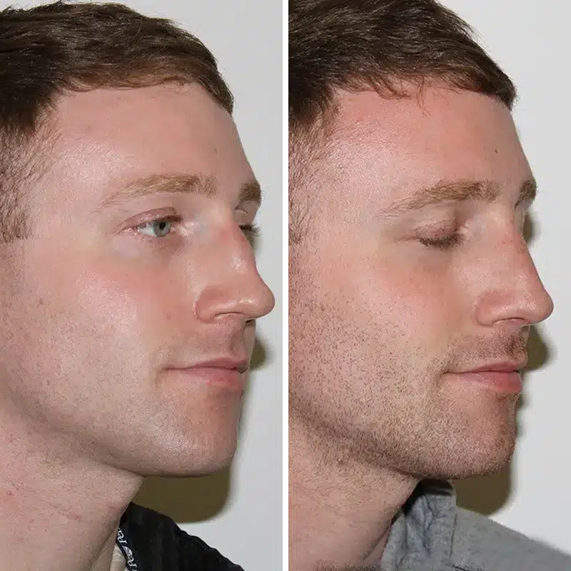 Before & After Photos Joanna Kam, MD