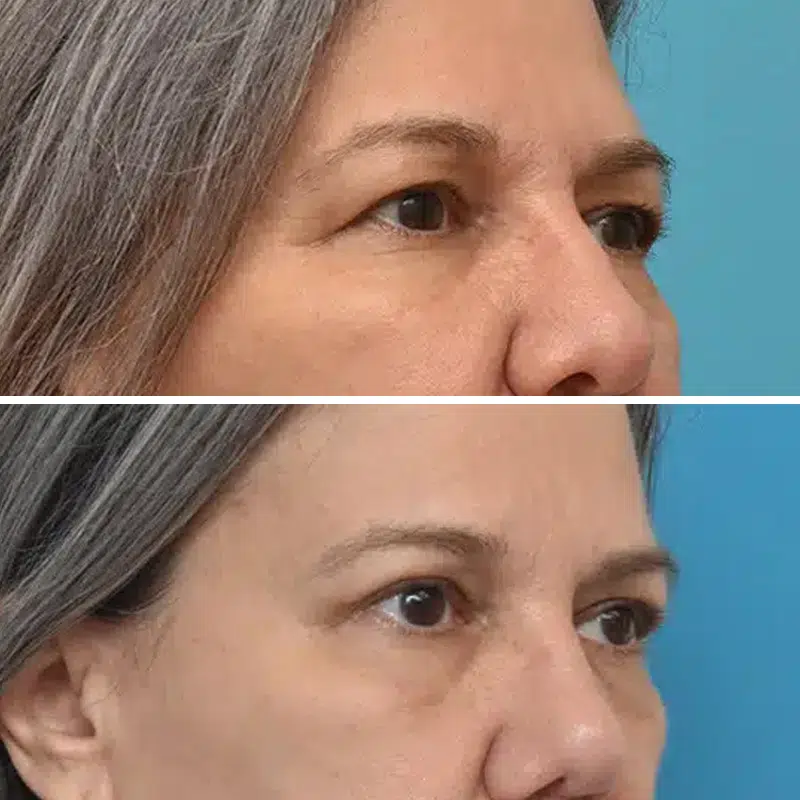 Before & After Photos Kirk Lozada, MD