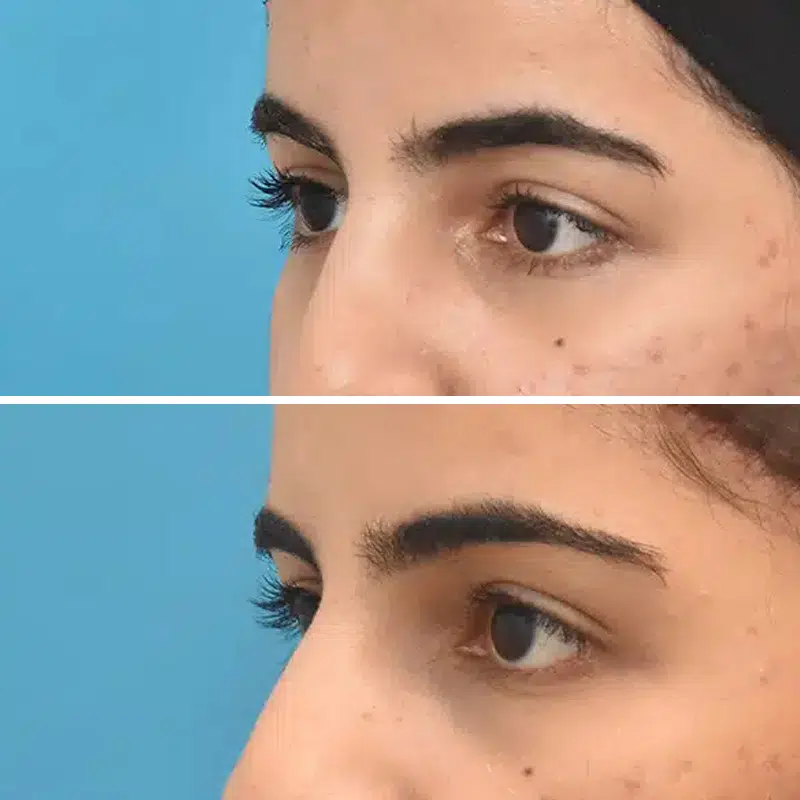 Before & After Photos Kirk Lozada, MD