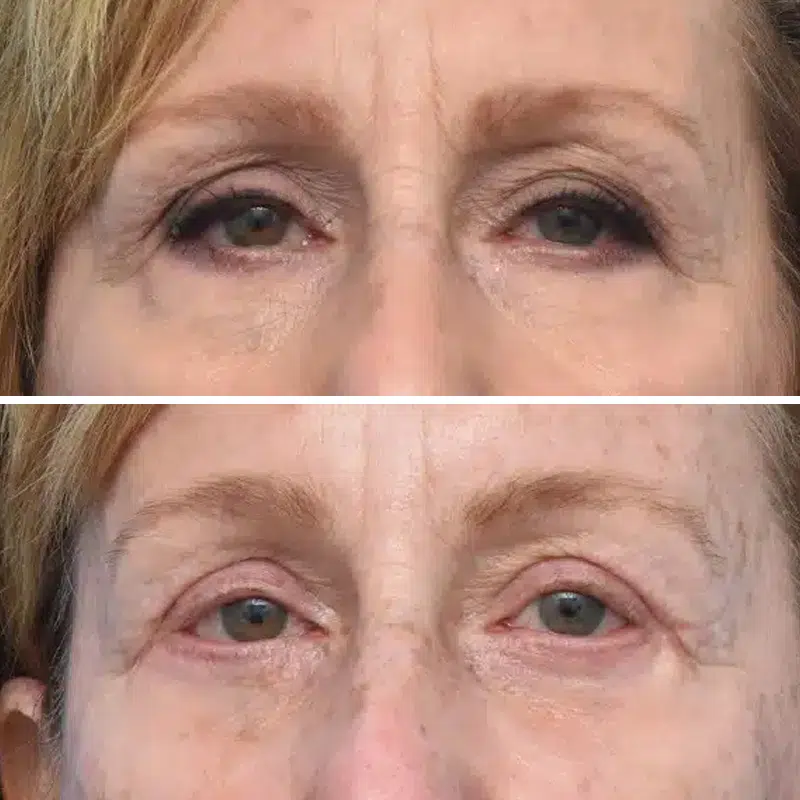 Before & After Photos Kirk Lozada, MD