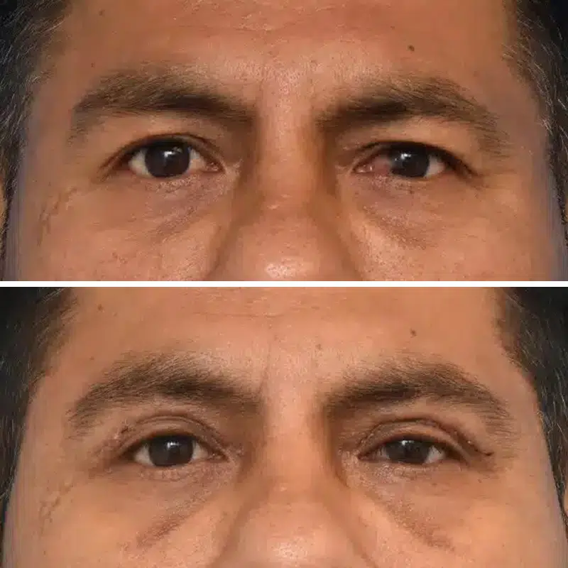 Before & After Photos Kirk Lozada, MD