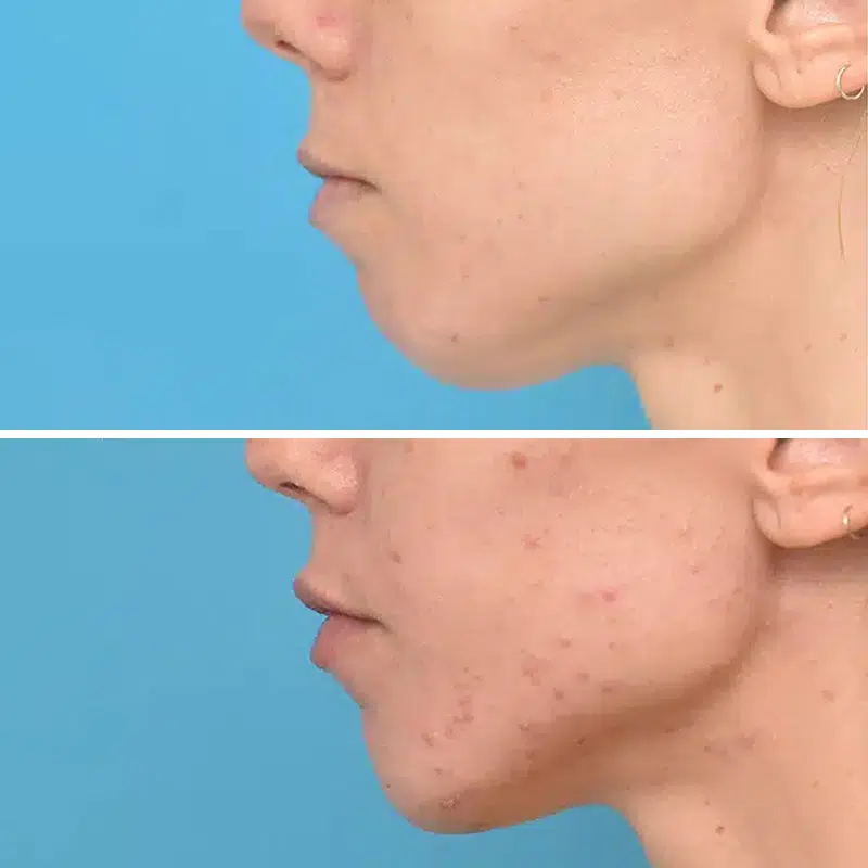 Before & After Photos Kirk Lozada, MD