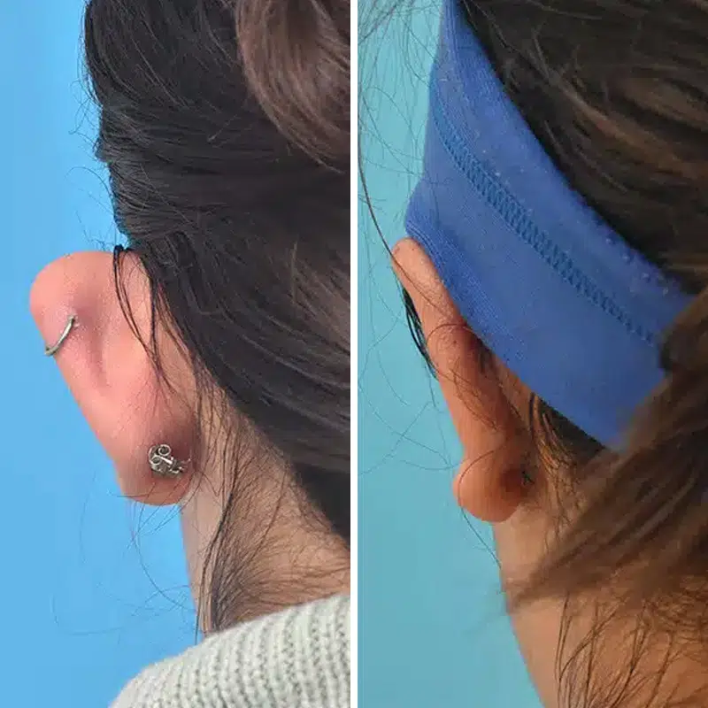 Before & After Photos Kirk Lozada, MD