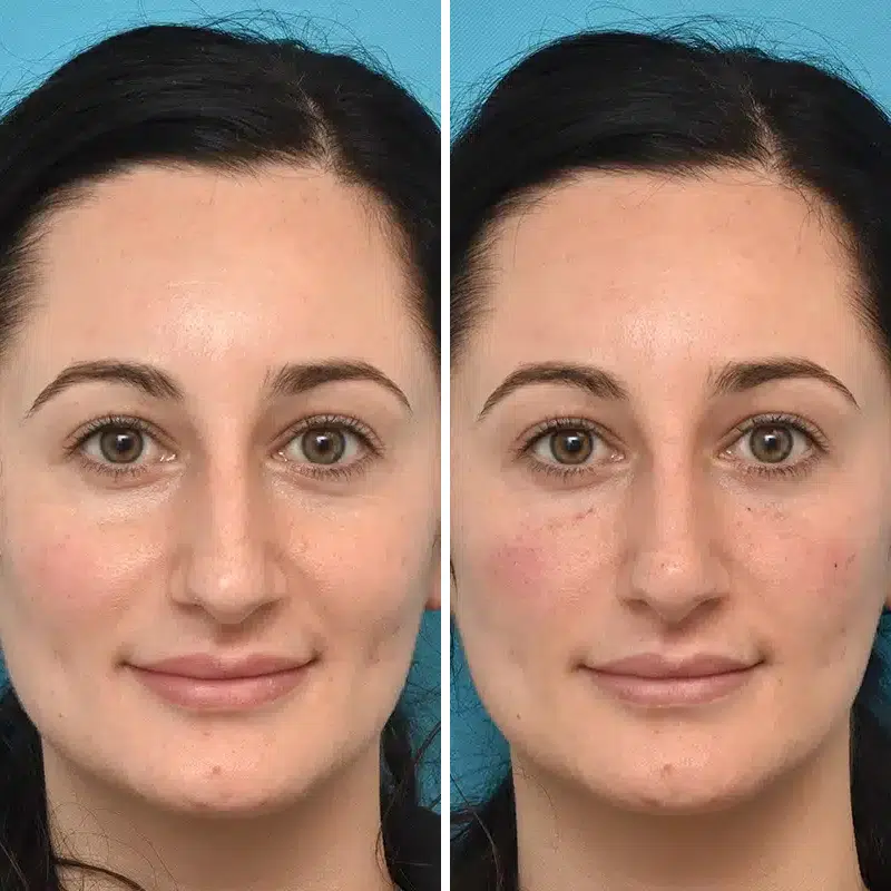 Before & After Photos Kirk Lozada, MD