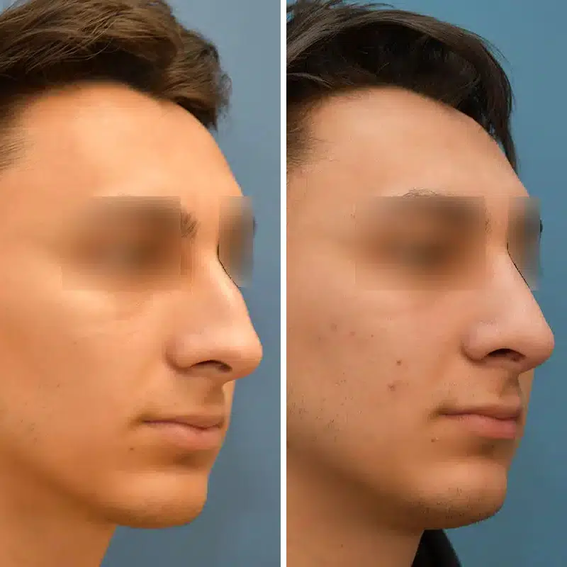 Before & After Photos Joanna Kam, MD