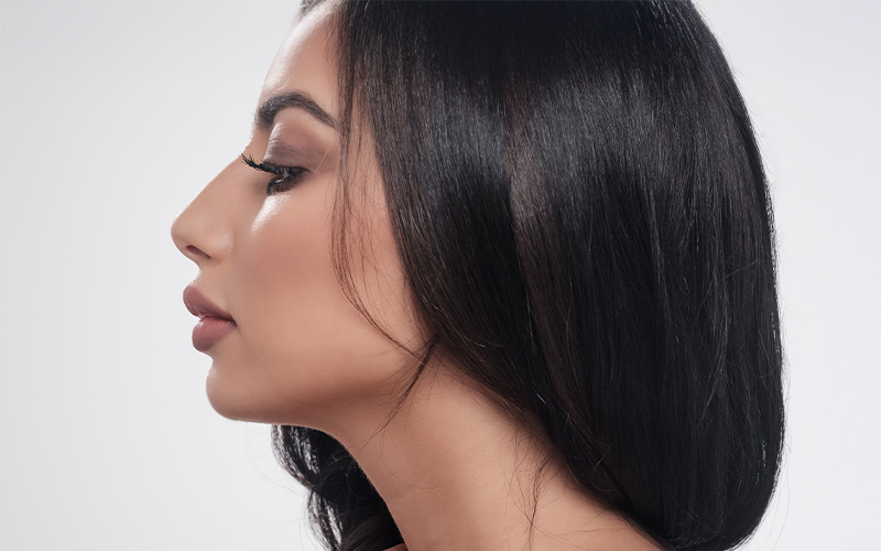Profile view of Middle Eastern woman with smooth nasal bridge and refined nose after rhinoplasty
