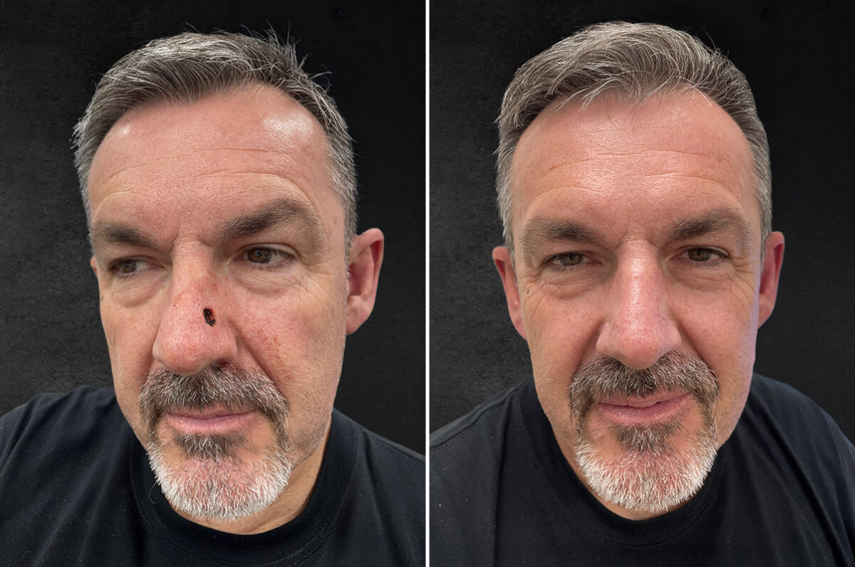 Reconstructive Surgery Before and After Photos in Philadelphia, PA, Patient 10719