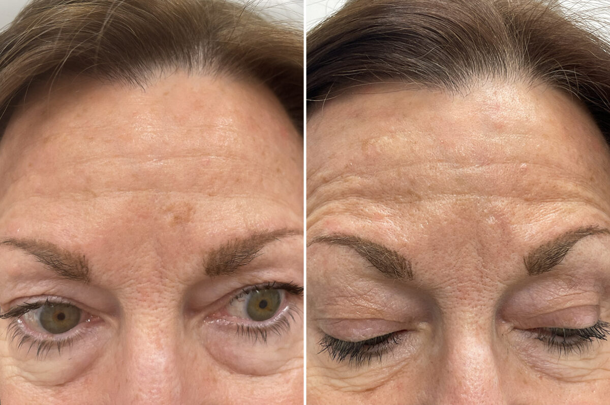 Reconstructive Surgery Before and After Photos in Philadelphia, PA, Patient 10726