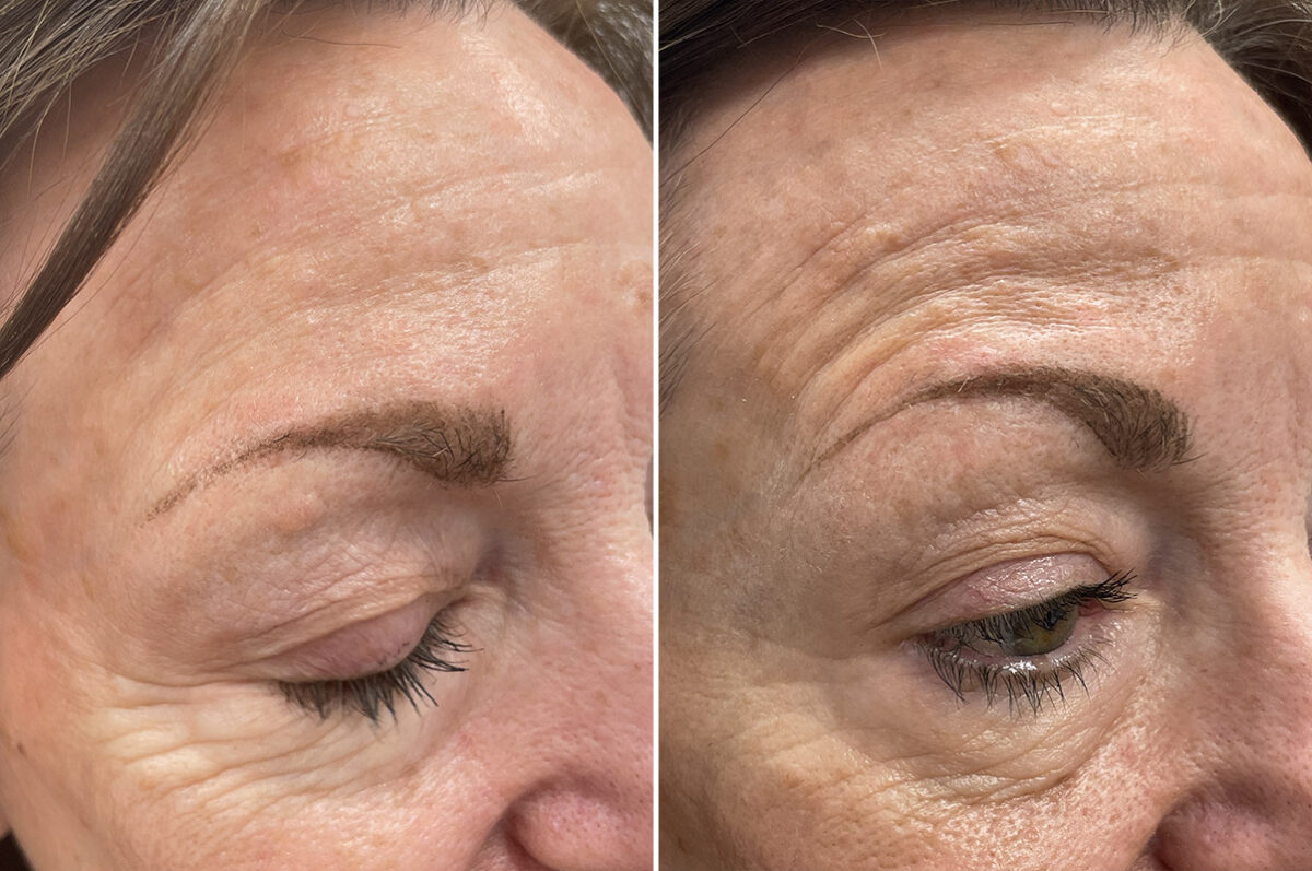 Reconstructive Surgery Before and After Photos in Philadelphia, PA, Patient 10726