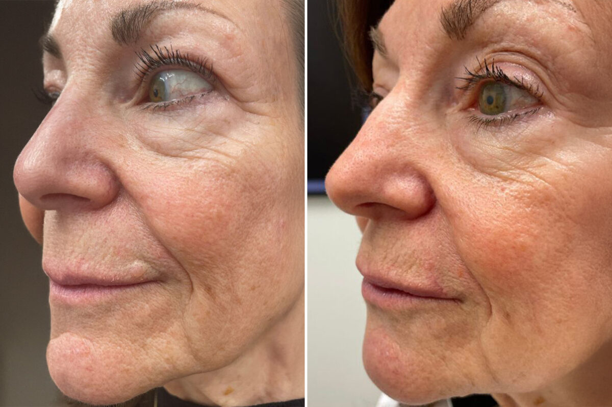 Reconstructive Surgery Before and After Photos in Philadelphia, PA, Patient 10726