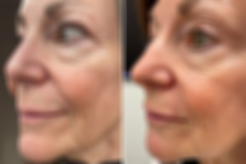 Reconstructive Surgery Before and After Photos in Philadelphia, PA, Patient 10726