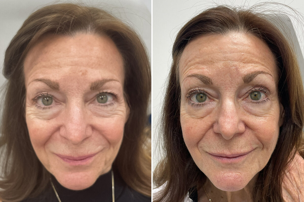 Reconstructive Surgery Before and After Photos in Philadelphia, PA, Patient 10726