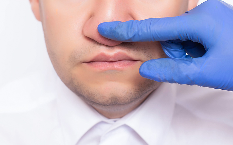 Doctor examining man's nose for congenital structural abnormalities that may require corrective functional rhinoplasty