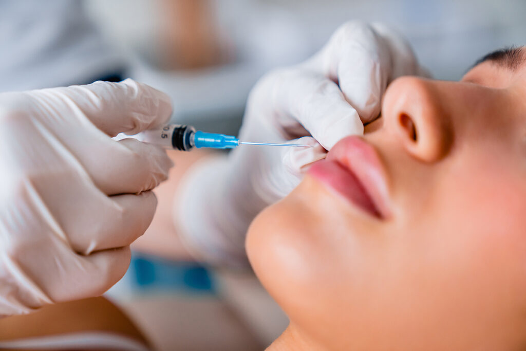 Close-up of patient receiving Botox injection near lips by a gloved professional using a fine needle
