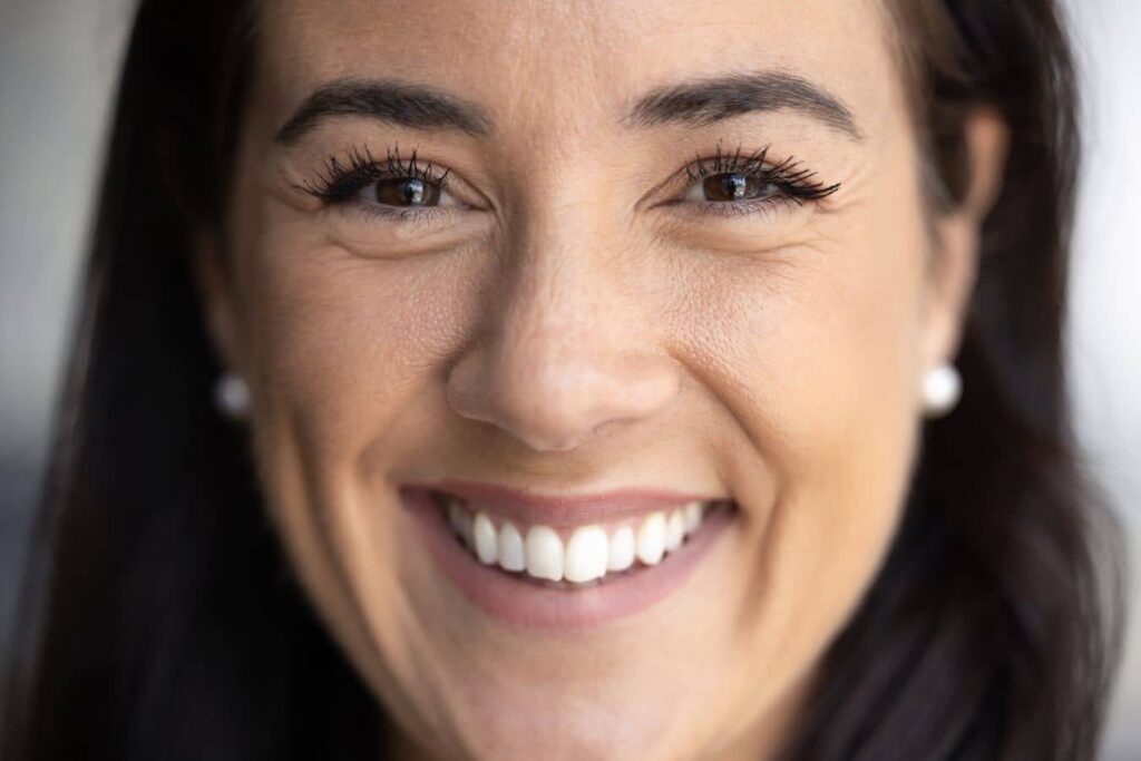 Smiling woman after rhinoplasty recovery, highlighting natural results and improved nasal appearance.