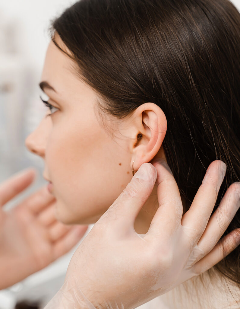 Patient during ear pinning recovery, showing post-surgery care with dressing and headband to support healing.