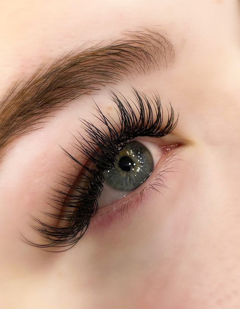 Longer, darker, fuller lashes after Latisse treatment.
