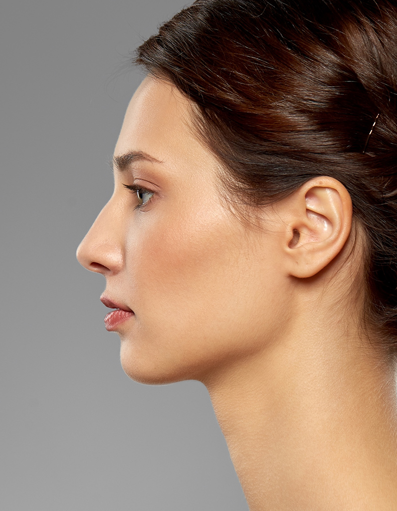 Side profile highlighting smooth, natural-looking results after liquid rhinoplasty
