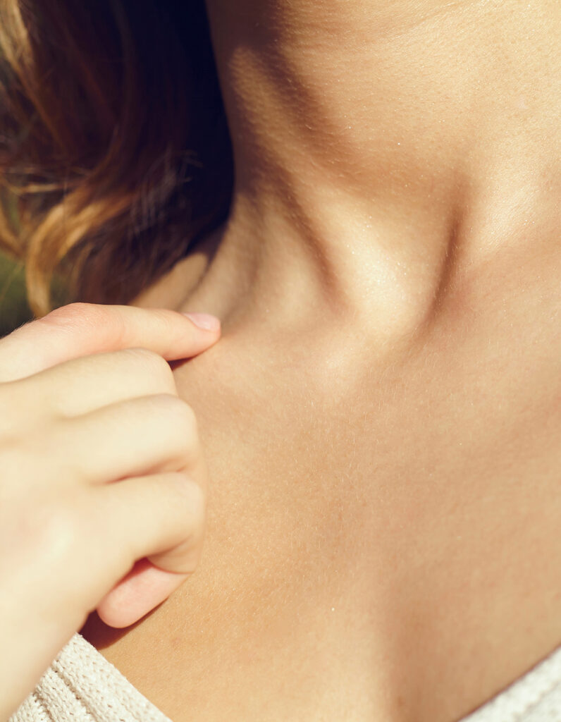 Close-up of neck skin illustrating neck lift procedure benefits, including improved contour and reduced sagging.