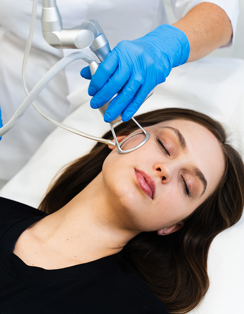 Patient receiving facial laser treatment during in-office procedure.