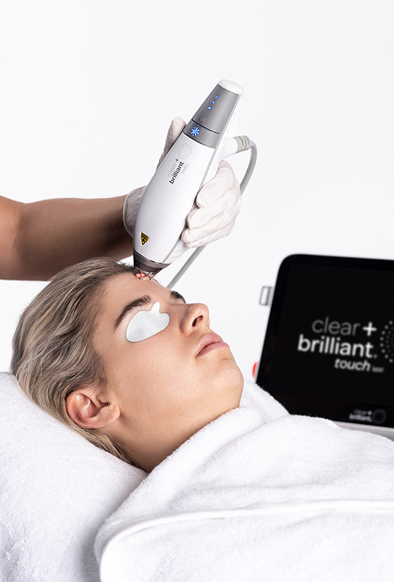 Practitioner performs Clear + Brilliant laser treatment on patient’s face with protective eye pads and handheld device.