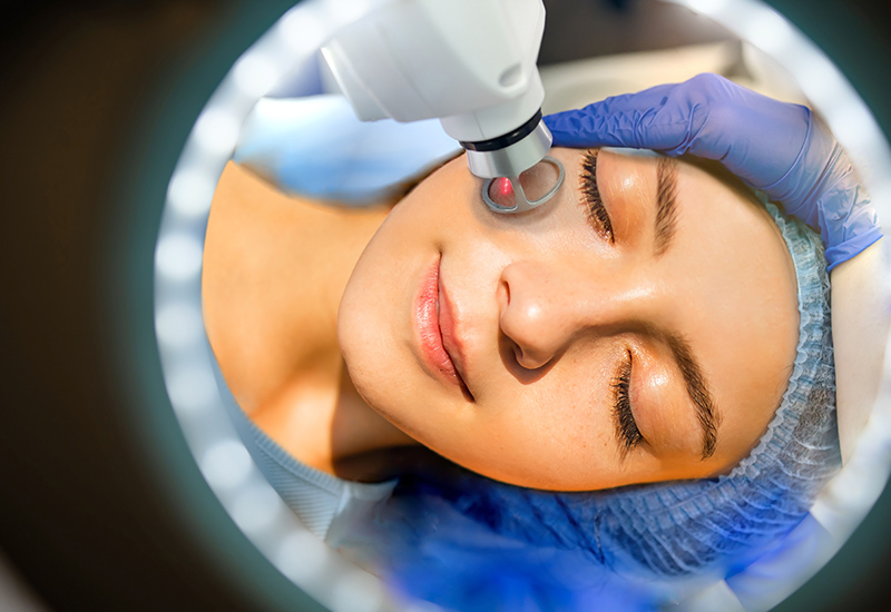 Patient receiving Clear + Brilliant facial laser treatment, illustrating gentle resurfacing for early aging and skin maintenance.