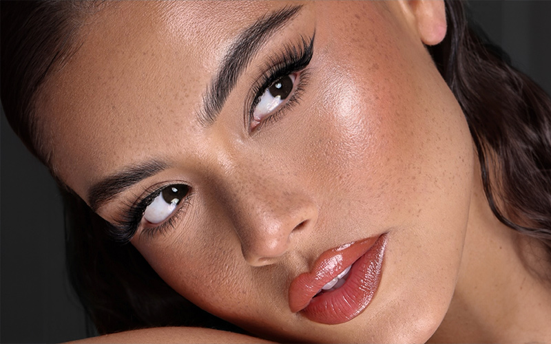 Refined nasal profile highlighting cosmetic rhinoplasty results