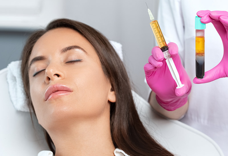 Patient receiving PRP facial treatment with microneedling while clinician holds syringe and platelet-rich plasma vial for skin rejuvenation.