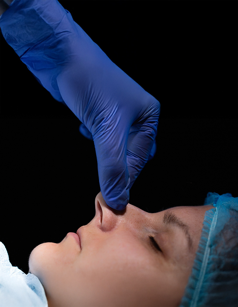 Surgeon examining patient’s nasal bridge during recovery after reconstructive rhinoplasty for saddle nose deformity.