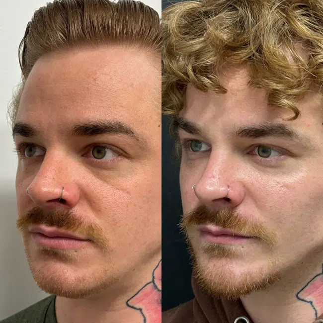 clai-facial-balance-01