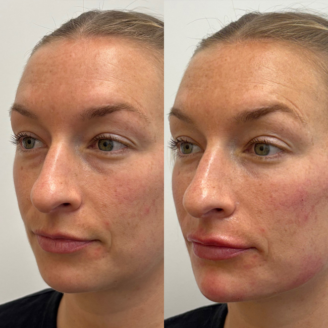 clai-facial-balance-02